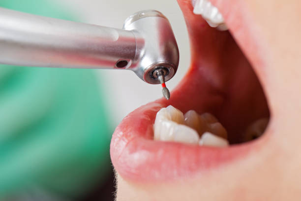 Best Emergency Root Canal Treatment in Wurtland, KY